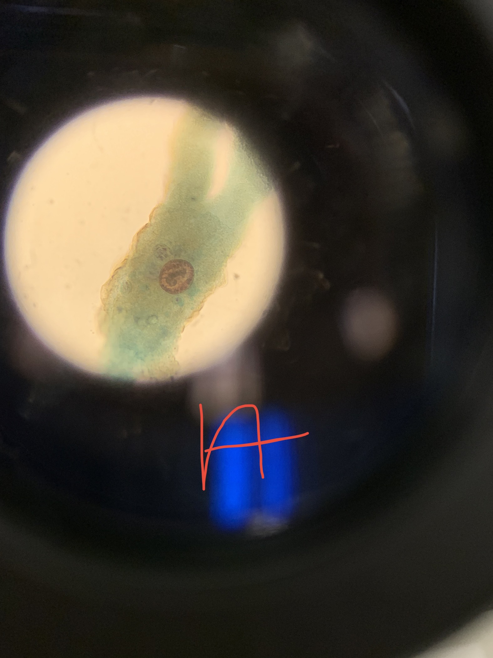 <p>protist?</p>
