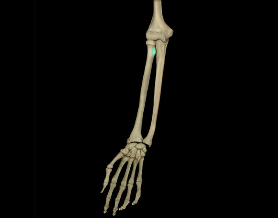 term image