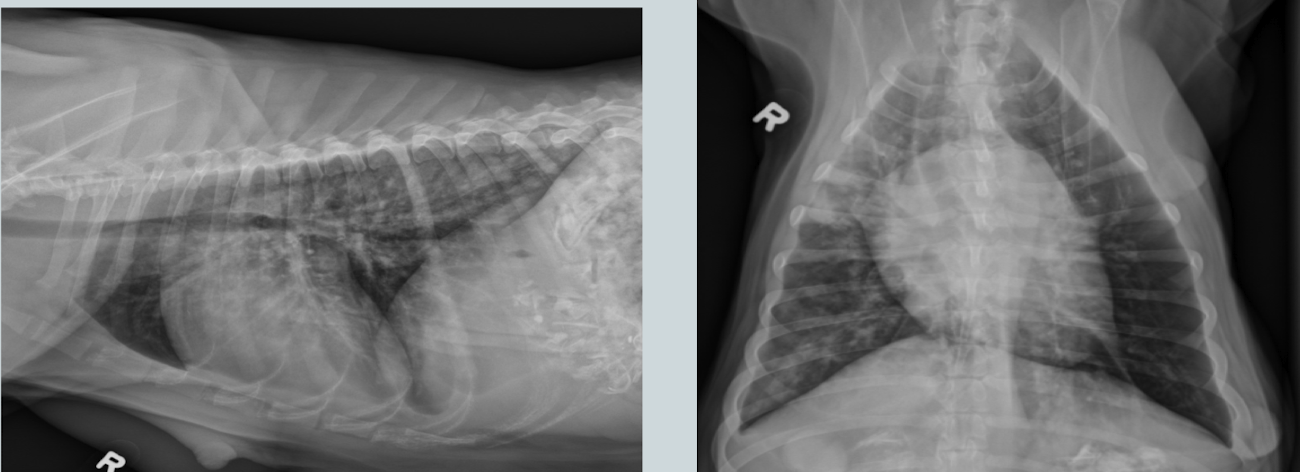 <p>What lung pattern? </p>
