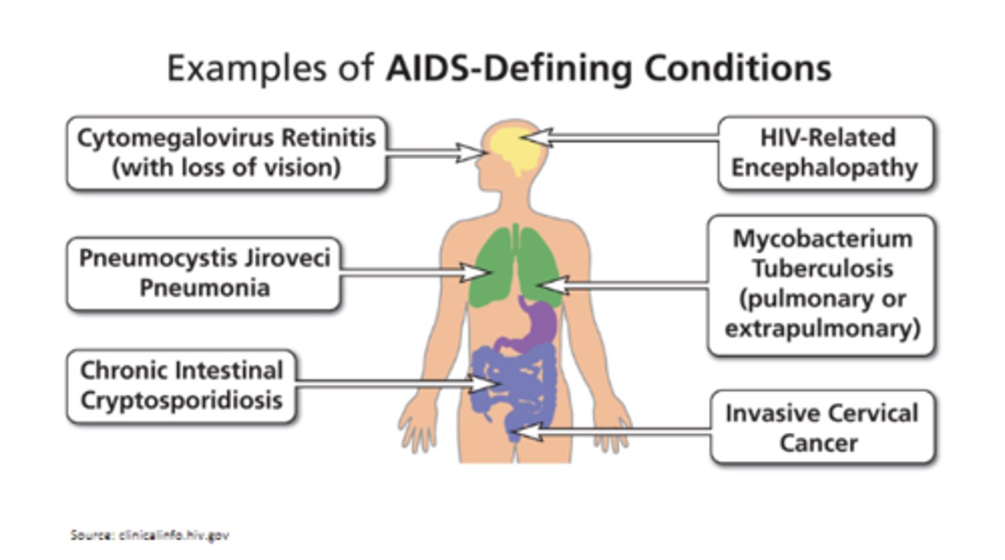<p>Esophageal/bronchial candidiasis, CA, Kaposi's sarcoma, Pneumocystis jiroveci pneumonia, disseminated infections, multiple fungal types of infections, TB</p>