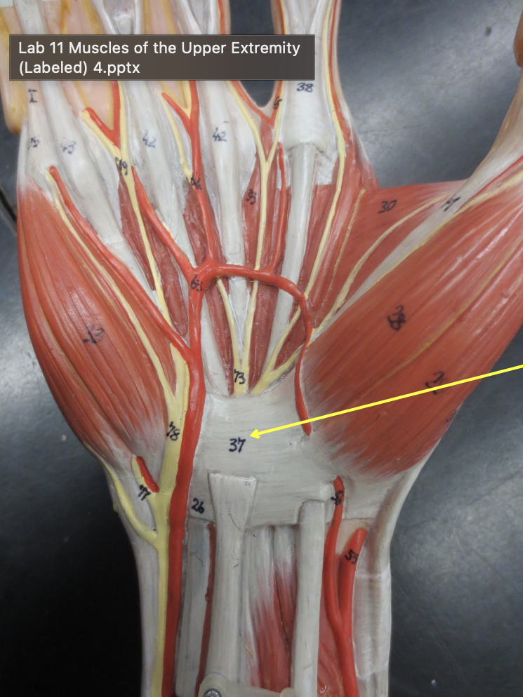 <p>Which Muscle</p>
