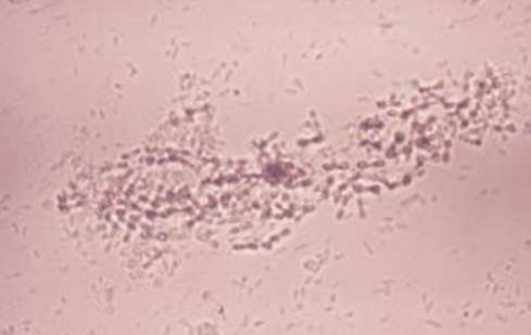 <p>What are these?</p>