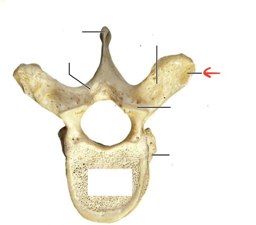 <p>on transverse processes</p>