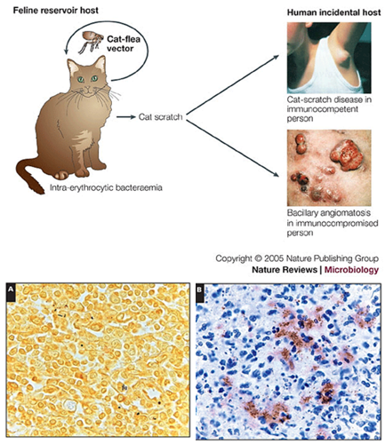 <ul><li><p><strong>Cat-scratch fever</strong> – Mild in healthy people, often in children, causing swollen lymph nodes near the scratch or bite. Can spread to organs in rare cases.</p></li><li><p><strong>Bacillary angiomatosis</strong> – Affects <strong>immunocompromised</strong> patients, causing abnormal blood vessel growth in skin, lymph nodes, liver, and spleen.</p></li></ul><p></p>