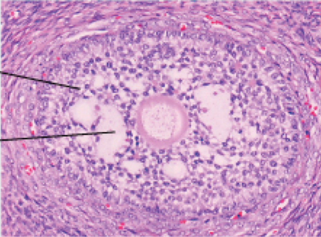 <p><span>Identify the following histology:</span></p>