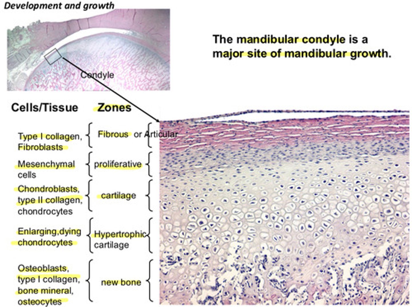 <p>the mandibular condyle</p>