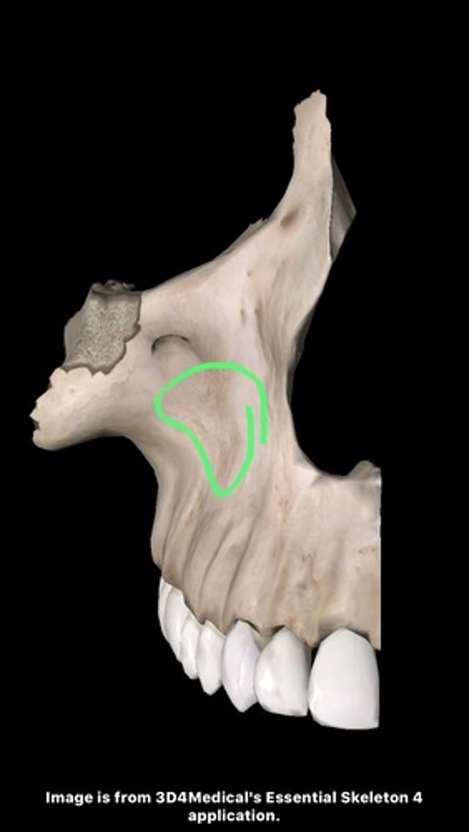 <p>hollow located on facial surface just below infraorbital foramen, where zygomatic, frontal, and alveolar processes of maxilla come together</p>