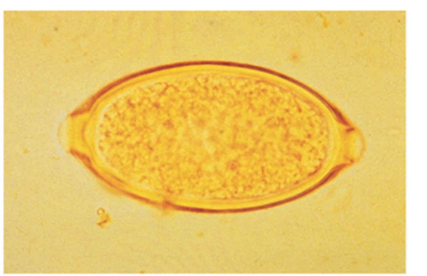 <p>This nematode ovum of the dog has a characteristic "football" shape with bipolar ends. This nematode is</p>
