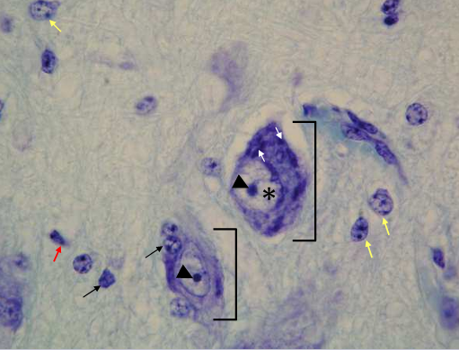term image