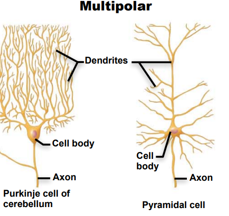 <p>Identify this neuron according to structure</p>
