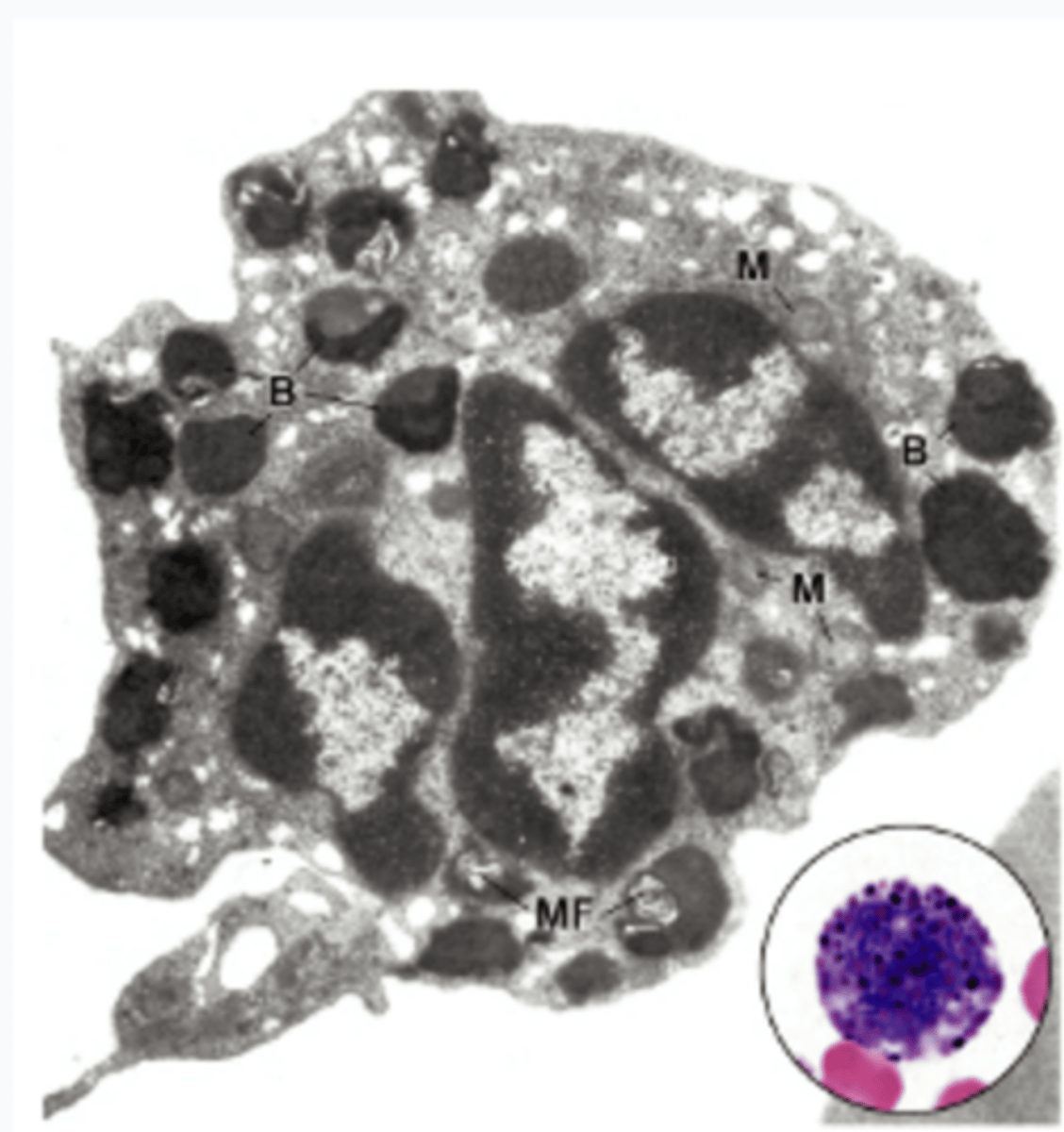 <p>Which of the following is FALSE about basophils? (Can be more than one)</p><p>A) They are the most abundant white blood cell in peripheral blood</p><p>B) They exhibit metachromasia in Romanowsky staining</p><p>C) They have abundant eosinophilic crystalline bodies that are released upon infection</p><p>D) They store abundant histamine in the granules</p>