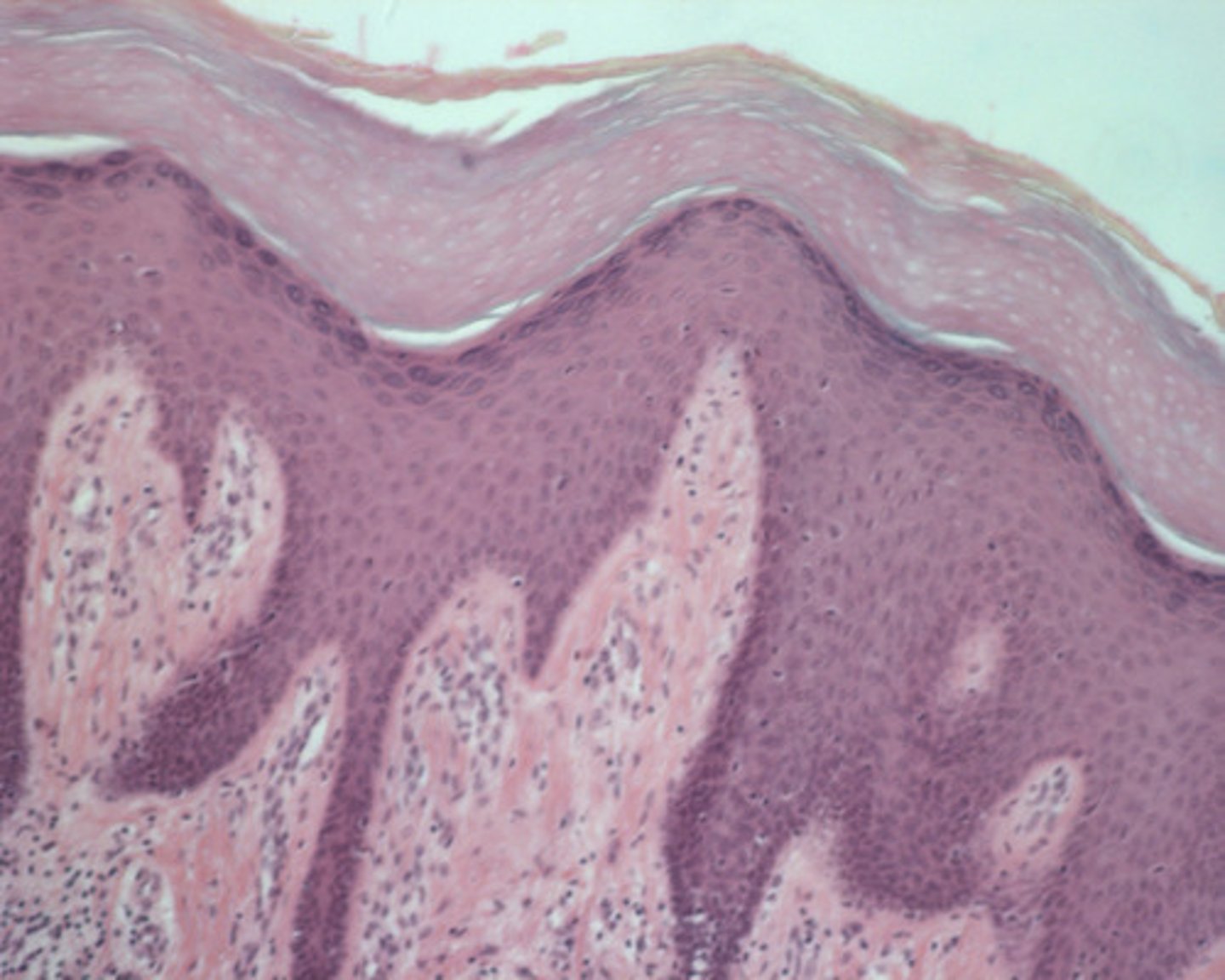 <p>DEFINITION</p><p>4-6 cell layers thick, begin to develop keratin, functions as an external water barrier; organelles deteriorating and cells stain dark</p>