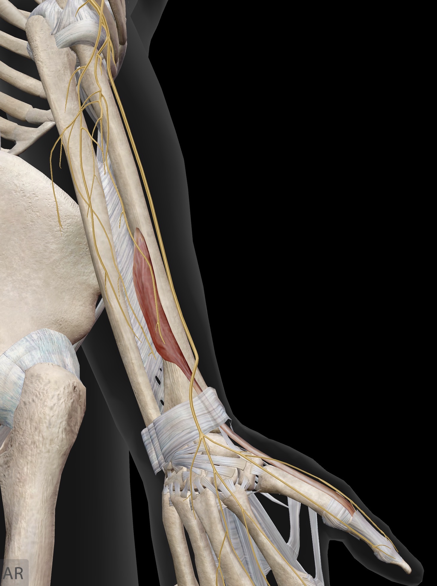 <p>Extensor pollicis brevis (EPB)</p><p>O: Middle portion of the radius (on the posterior aspect)</p><p>I: Base of proximal phalanx of thumb</p><p>A: Extension of the thumb at the MCP joint and CMC joint</p><p>IN: Radial nerve (C5-C8, T1)</p>