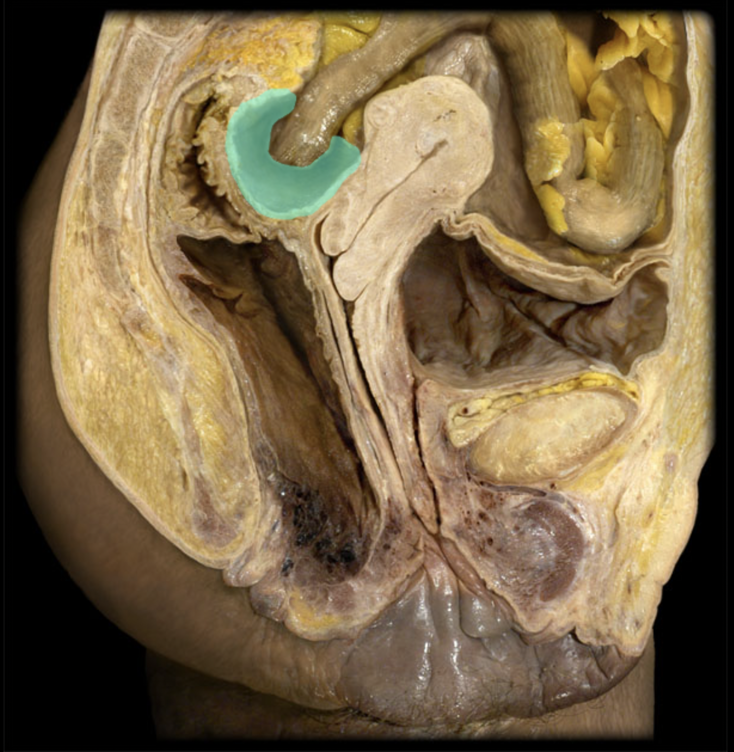 <p>What structure is shown?</p>