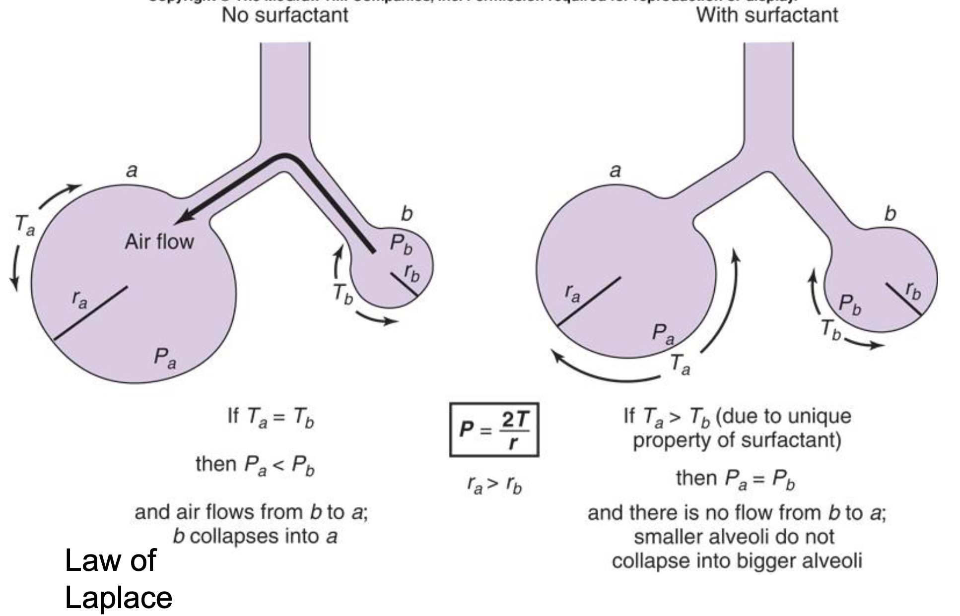 <p>when two alveoli with different sizes dont have surfactant, their surface tension will be the same; this then creates a pressure gradient between the two alveoli</p><ul><li><p>the small alveoli will collapse and blow up the big alveoli</p></li></ul><p></p>