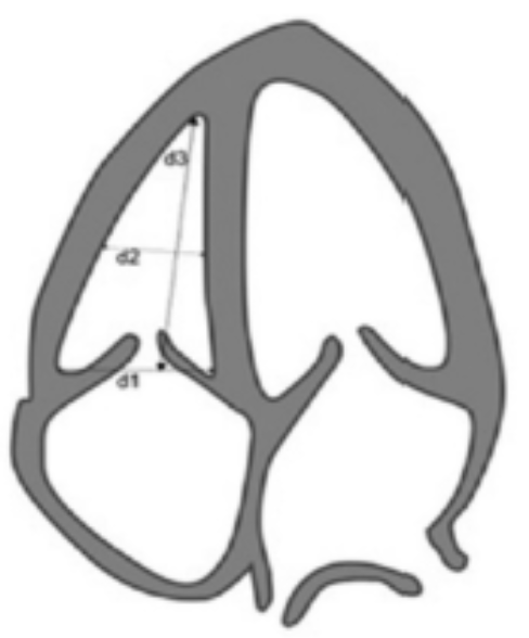 <p>In 2D at <strong>AP4</strong> at end diastole</p>