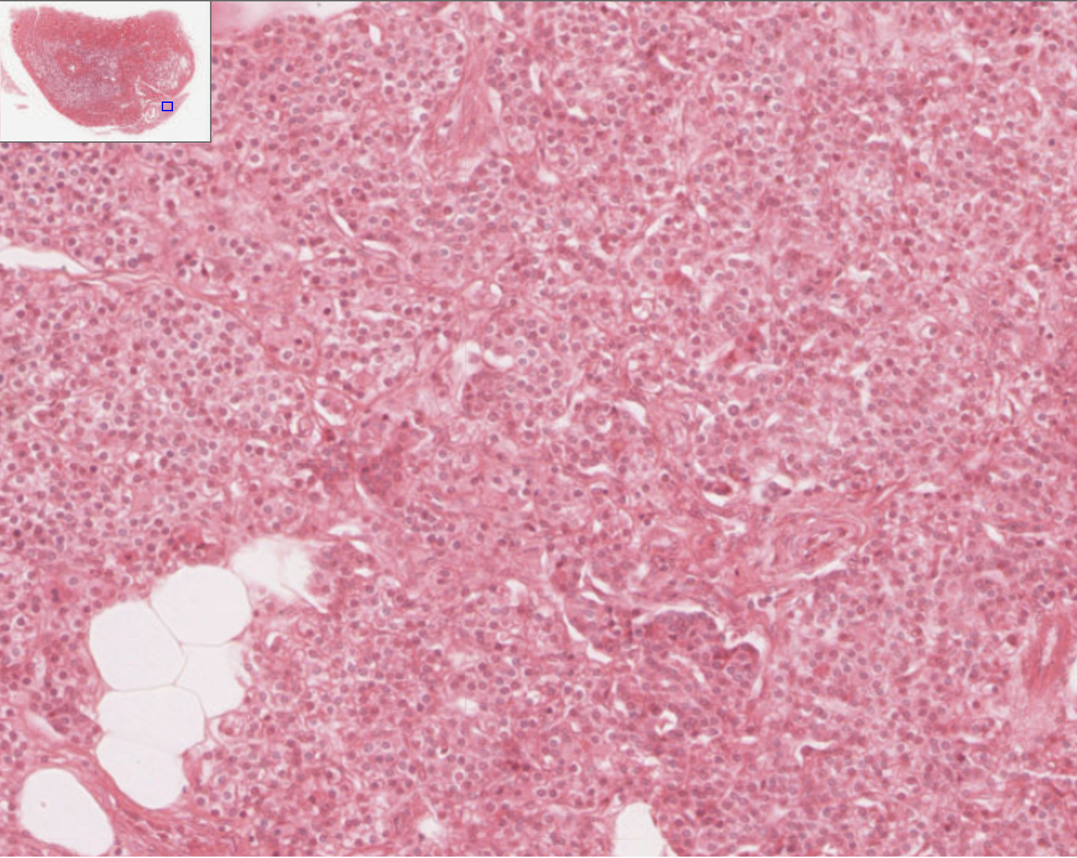 <p>How can you identify the parathyroid gland on a slide?</p>