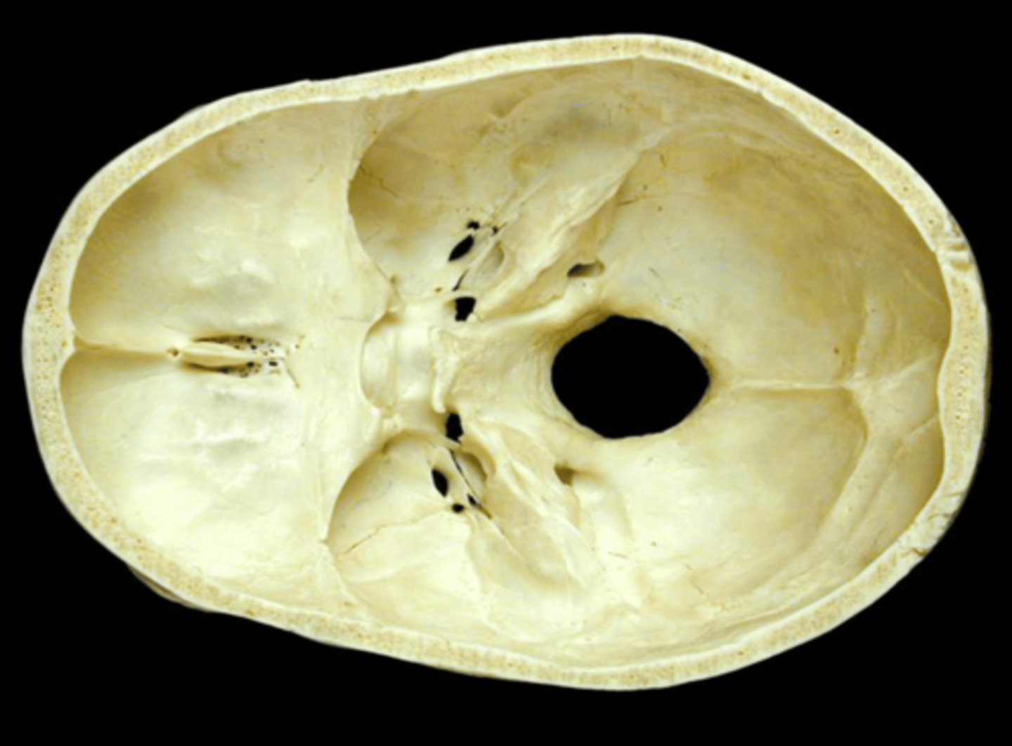 <p>cranial vault and cranial floor</p>