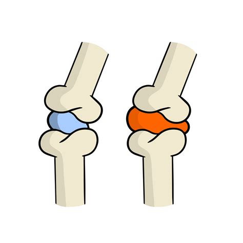 <p><strong>CARTILAGE</strong></p>