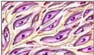 <p>Identifica el tipo de tejido</p>