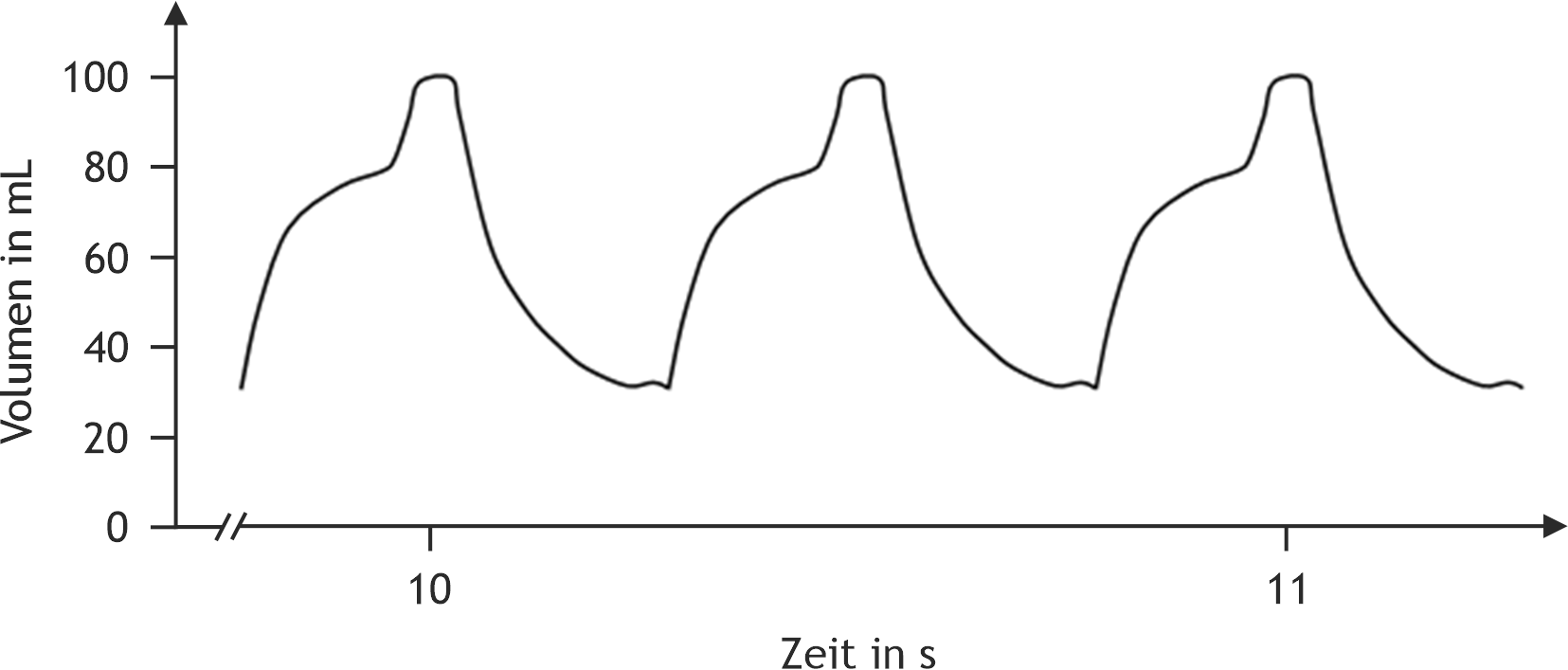 <p>34. In a patient undergoing cardiac evaluation, the following recording of left ventricular volume as a function of time is obtained.</p><p>In which range is the patient’s cardiac output?</p><p>A. < 7 L/min</p><p>B. 7 L/min to 9 L/min</p><p>C. 9.1 L/min to 11 L/min</p><p>D. 11.1 L/min to 13 L/min</p><p>E. > 13 L/min</p>