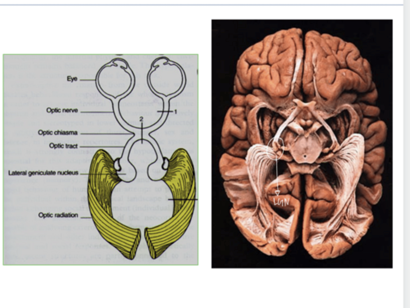 <p>LGN in Brain (Pic)</p>