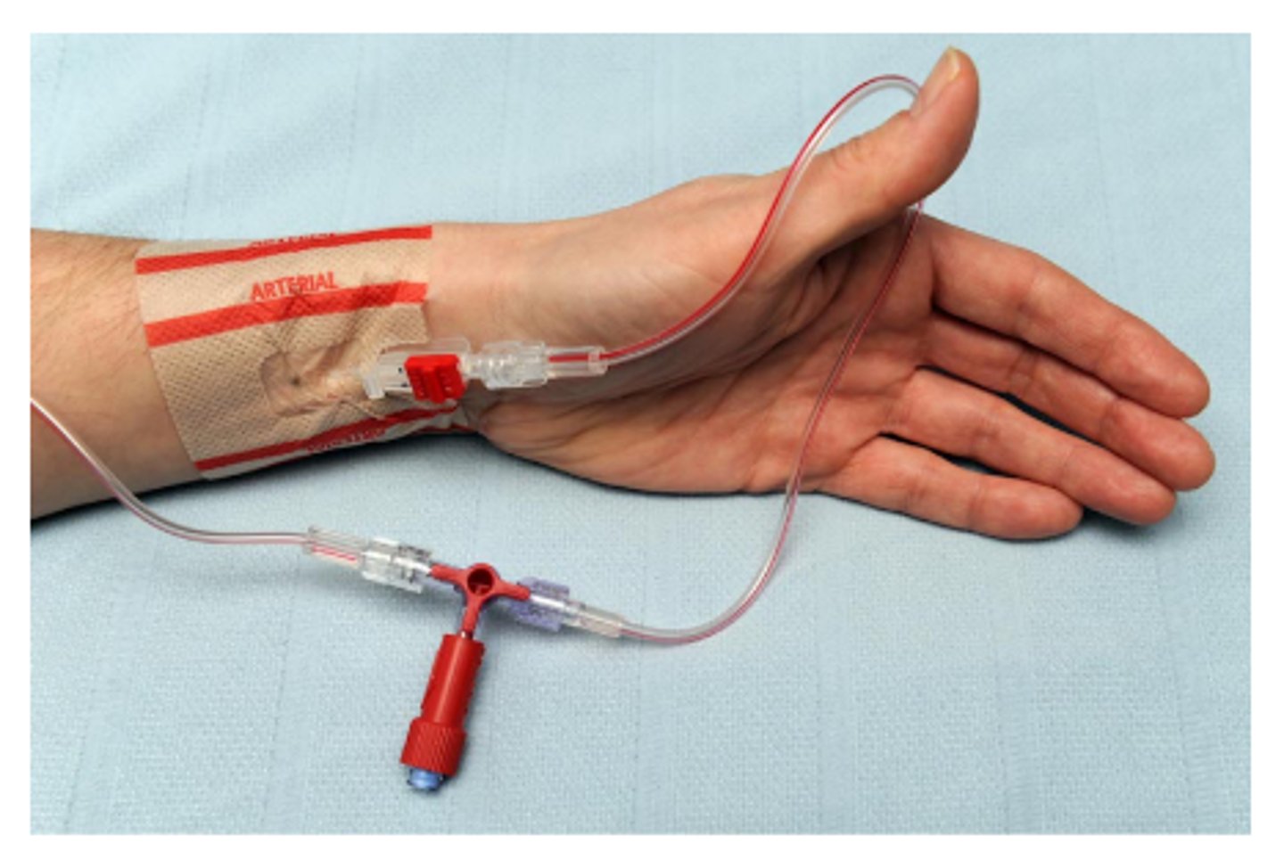 <p>Arterial lines are usually _____________________ in color. This one would likely require _______________________ d/t location.</p>