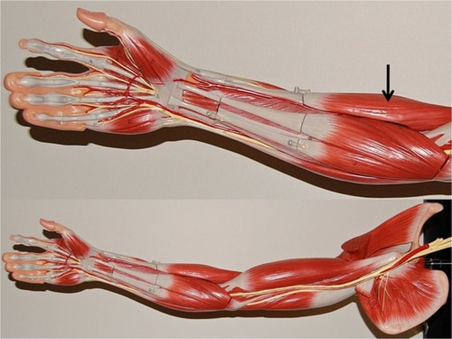 <p>A muscle that flexes the forearm at the elbow.</p>
