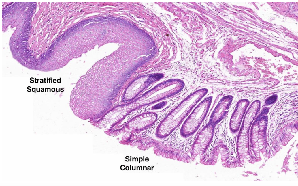   	 		 		 	 	 		

Rectum terminates at the anal canal with an abrupt change to **stratified squamous epithelium; it** is **nonkeratinized** in **the proximal portion and** switches **to keratinized in the distal** portion which then becomes continuous with the outside hairy skin 

\
Extra info

\
**Look at the photo to understand this;**  	 		 		 	 	 		

• Circular layer of the rectum / anal muscularis forms the internal anal sphincter and the surrounding striated muscle forms the external anal sphincter  

 	 

 	 