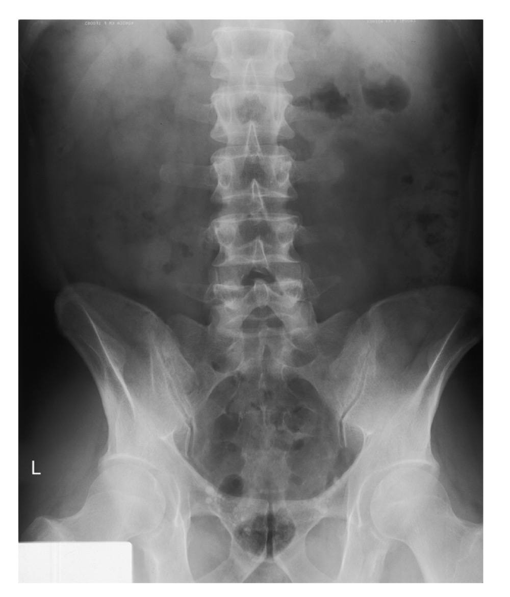 <p>A radiographic view of the abdomen used to evaluate abdominal and urinary structures; may not show all structures, but helps visualize soft tissues and can indicate exposure quality (e.g., borders of psoas major muscles).</p>