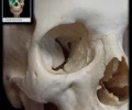 <p>Superolaterally directed process Minor contribution to orbital floor Orbital floor formed by maxilla (orbital surface), zygomatic bone (orbital surface), and palatine bone (orbital process)</p>