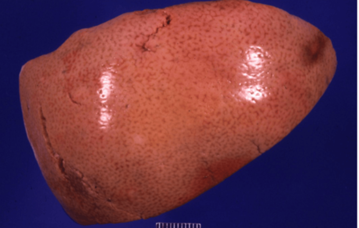 <p>- Enlarged pale liver (Similar to liver with lipidosis but not yellow and greasy)</p><p>- Description of image: The liver is diffusely enlarged. it is pale/tan and it is extremely soft.</p>
