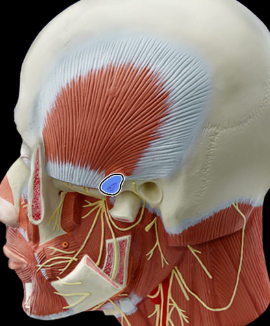 <p>Zygomatic process of temporal bone</p>