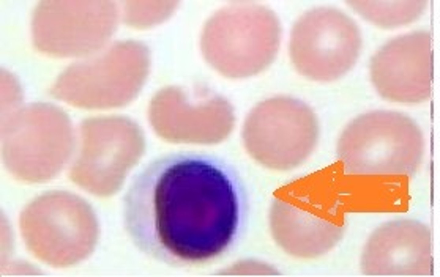 <p>Name the leukocyte.</p>