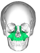 <p>What bone of the skull is this?</p>