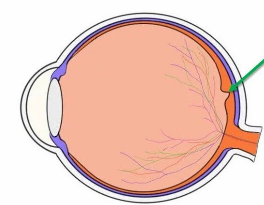 <p><u>Label The Eye</u></p>