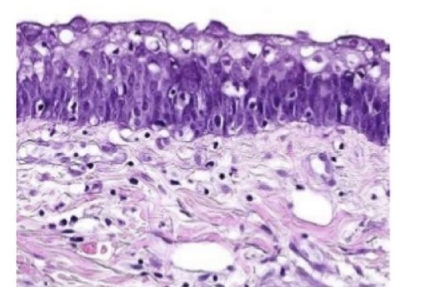 <p>inferior surface, respiratory</p>
