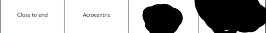 <p>What is the Metaphase and Anaphase shape of The centromere close to end with Acrocentric designation (Draw the figure to familiarize)</p>
