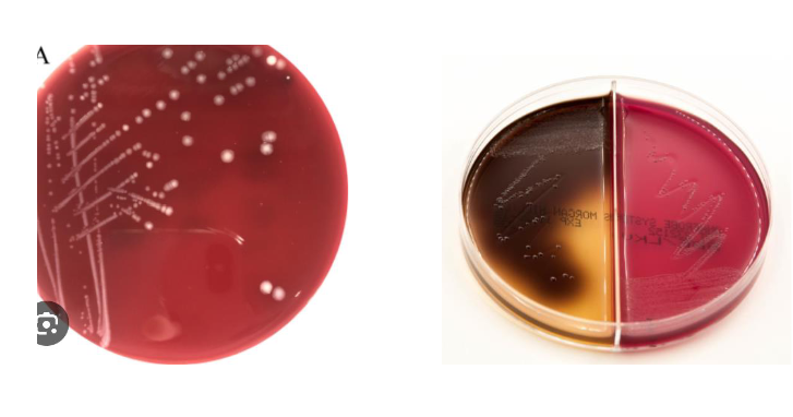 <p>lets say your gram stain showed GNB so you sub-cultured to a BBE plate but instead of black you saw clear growth, what organism would this be</p>