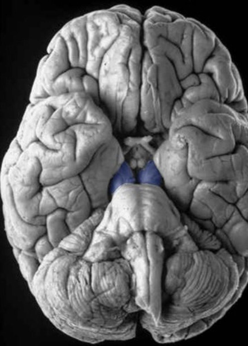 <p>basis pedunculi (or crus cerebri)</p>