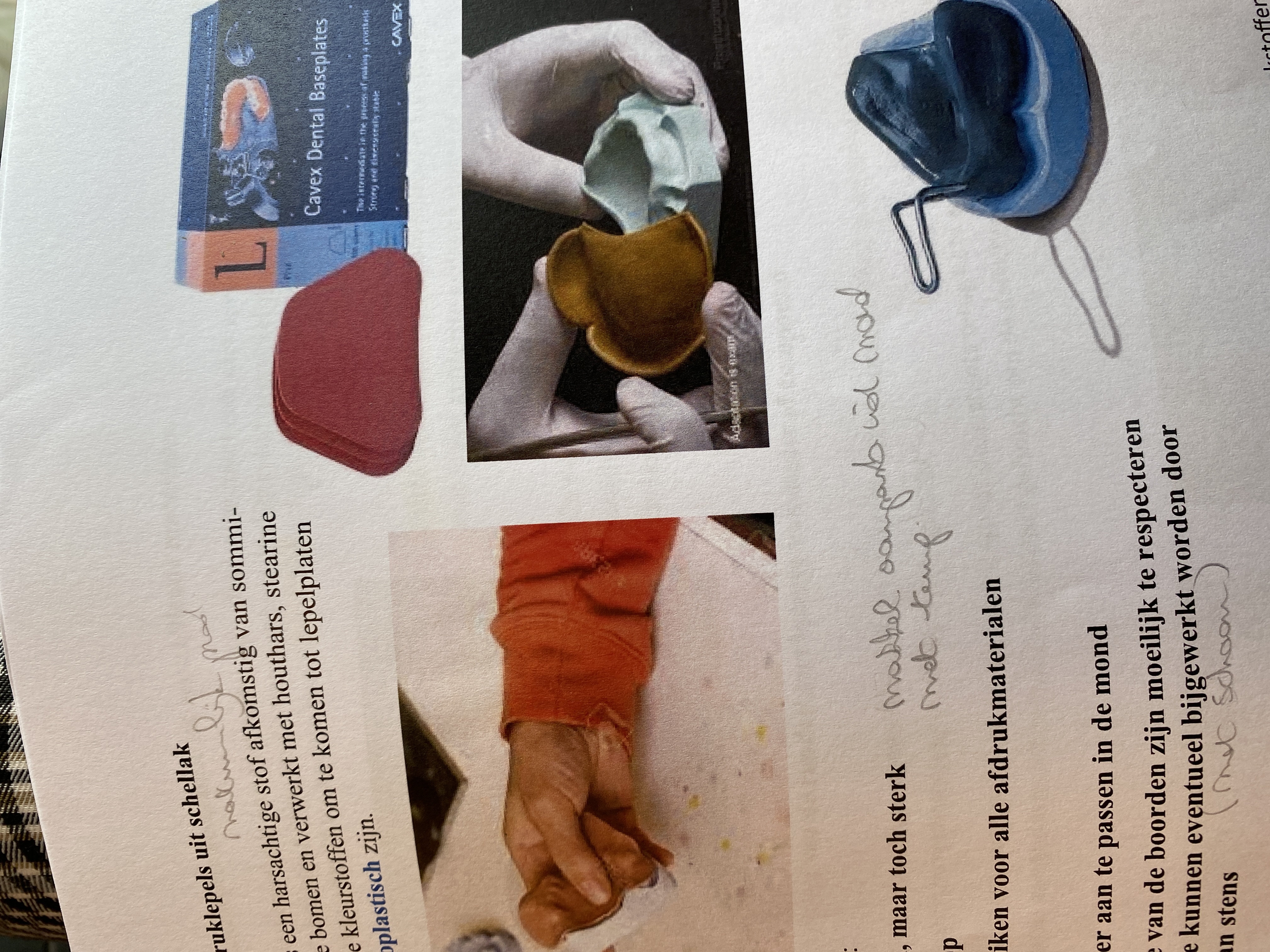 <p>Wat zijn de voordelen van shellak?</p>