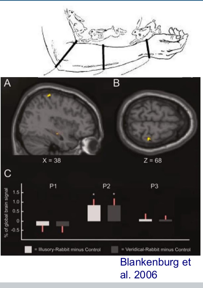 <ul><li><p>Middle location equally activated as stimulated location</p></li><li><p>This graph shows&nbsp;<strong>% of global brain signal</strong>&nbsp;in three different skin locations:</p><ul><li><p><strong>P1</strong>&nbsp;= First stimulated location</p></li><li><p><strong>P2</strong>&nbsp;= Middle location (where no touch occurred)</p></li><li><p><strong>P3</strong>&nbsp;= Final stimulated location</p></li></ul></li><li><p>Two conditions are shown:</p><ul><li><p><strong>Illusory-Rabbit minus Control</strong>&nbsp;(white bars): Real taps only on P1 and P3 (wrist and elbow),&nbsp;<strong>but illusion of tapping at P2</strong></p></li><li><p><strong>Veridical-Rabbit minus Control</strong>&nbsp;(gray bars): Real taps at&nbsp;<strong>all three</strong>&nbsp;locations (P1, P2, P3)</p></li></ul></li><li><p><strong>Key result</strong>:</p><ul><li><p>The&nbsp;<strong>P2 activation</strong>&nbsp;in the&nbsp;<em>illusory condition</em>&nbsp;(white bar) is&nbsp;<strong>just as strong</strong>&nbsp;as in the&nbsp;<em>real stimulation condition</em>&nbsp;(gray bar).</p></li><li><p>This means the brain&nbsp;<strong>"believes"</strong>&nbsp;it was touched at P2 — even though&nbsp;<strong>no physical stimulus occurred there</strong>.</p></li></ul></li></ul><p></p>