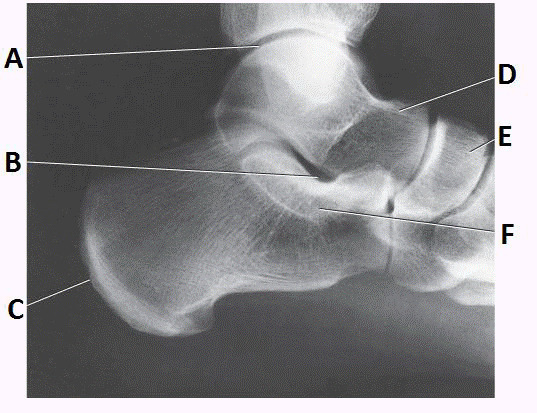 <p>tibiotalar joint</p>