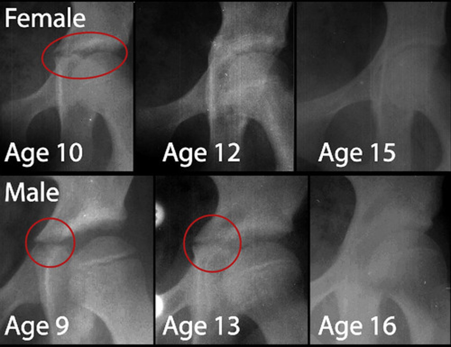 <p>girls: ~12 years old</p><p>boys: ~14 years old</p><p>about the time of PHV</p>
