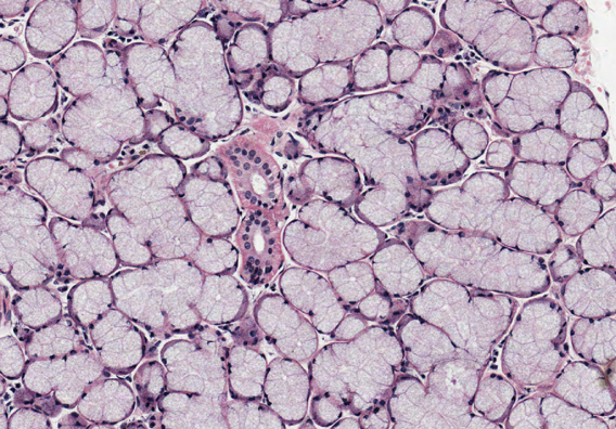 <p>Identify this gland. Is it a serous, mucous, or mixed gland?</p>