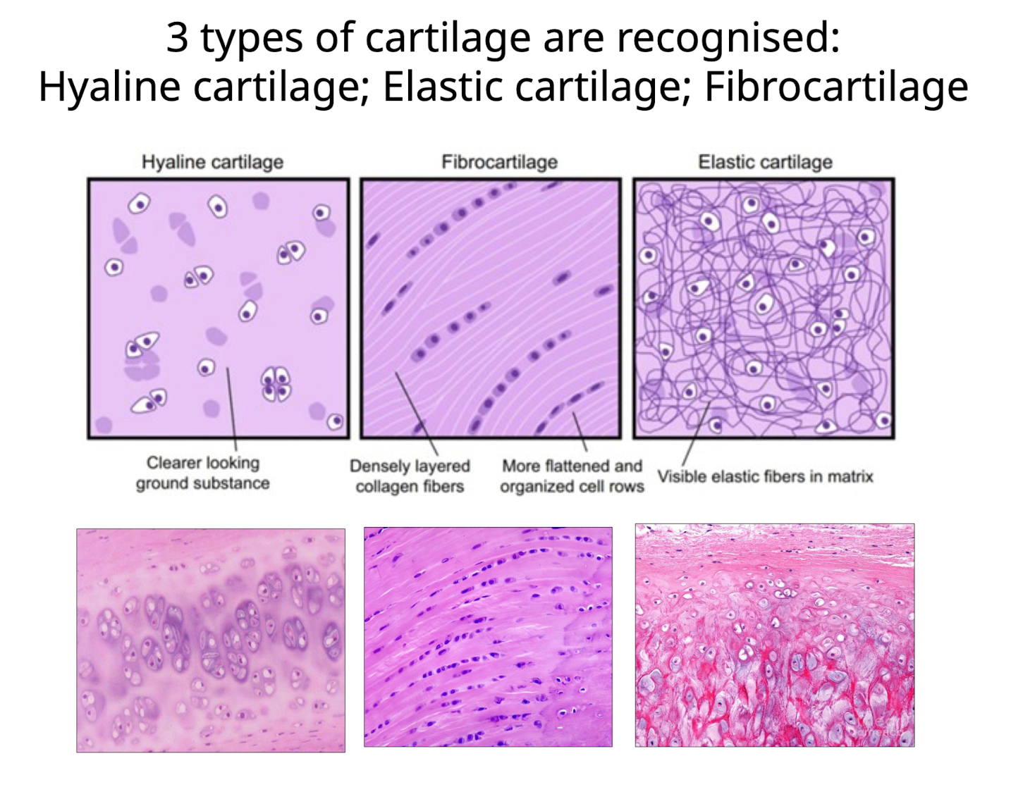 <ol><li><p>Hyalin (clear-looking ground substance)</p></li><li><p>Fibrocartilage (cells occur in chords or in alignment between strands of collagen fibers)</p></li><li><p>Elastic Cartilage (Visible elastic fibers throughout matrix)</p></li></ol><p></p>