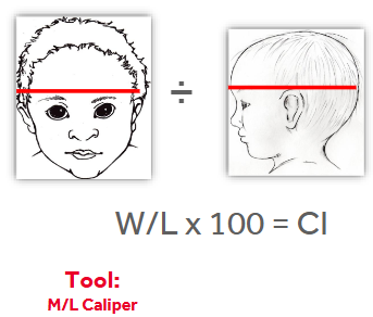<p>Cranial Width - at widest dimension </p><p>Cranial Length - at longest dimension </p><p><em>Cephalic Index (CI) = Width / Length x 100</em></p>