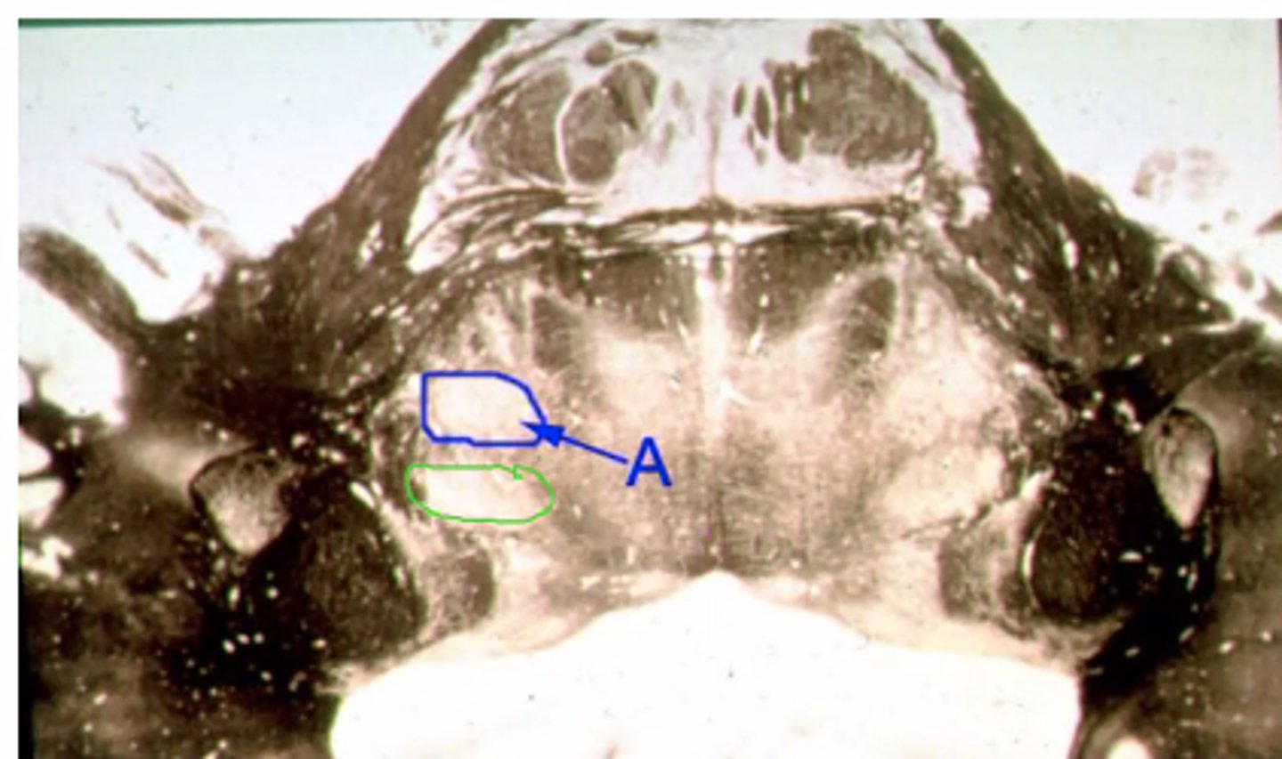 <p>Identify the structures indicated by the green outline</p>
