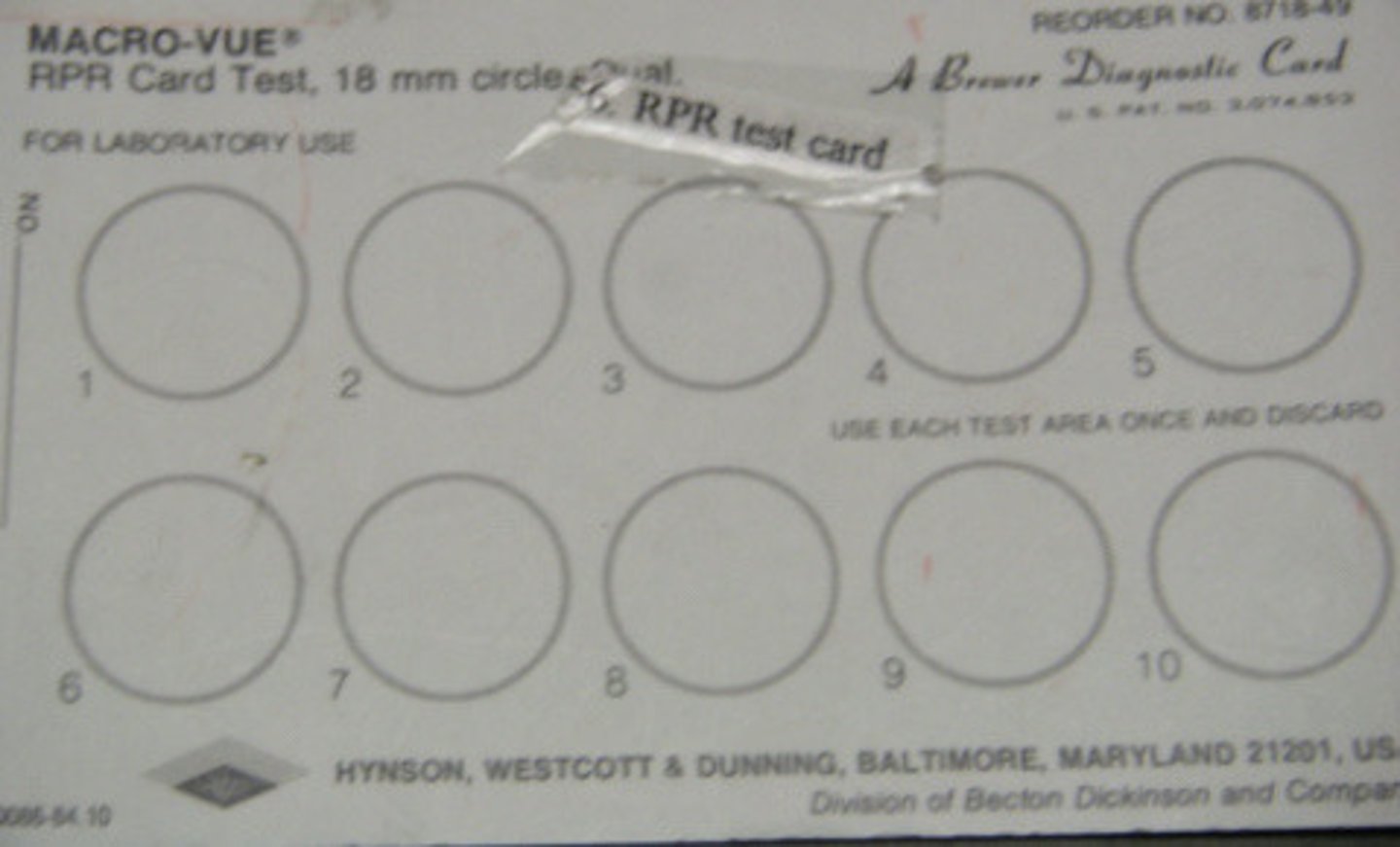 <p>Test card used for the serological detection of syphilis.</p>