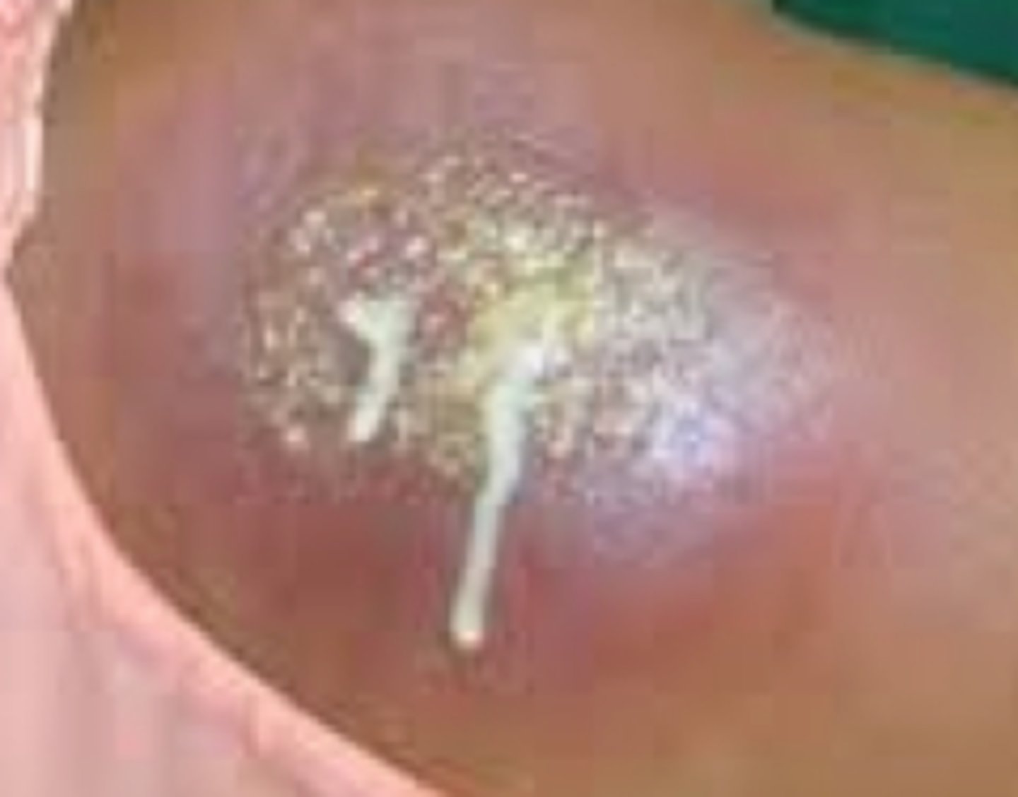<p>What is the diagnosis?</p>